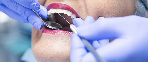 Best Emergency Treatment for Toothache in Hamton, IL